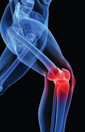 Burleigh Physio Runaway Bay Physio