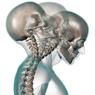 Gold Coast Physio Gold Coast Physio Labrador Burleigh Runaway Bay