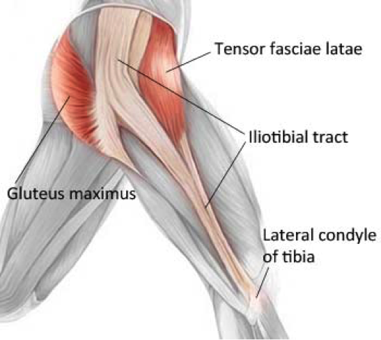 ITB ITB friction & gold coast physio & sports health